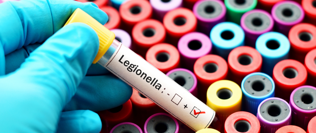 Informacje o bakterii Legionella sp.