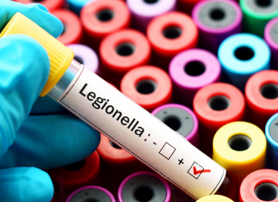 Informacje o bakterii Legionella sp.